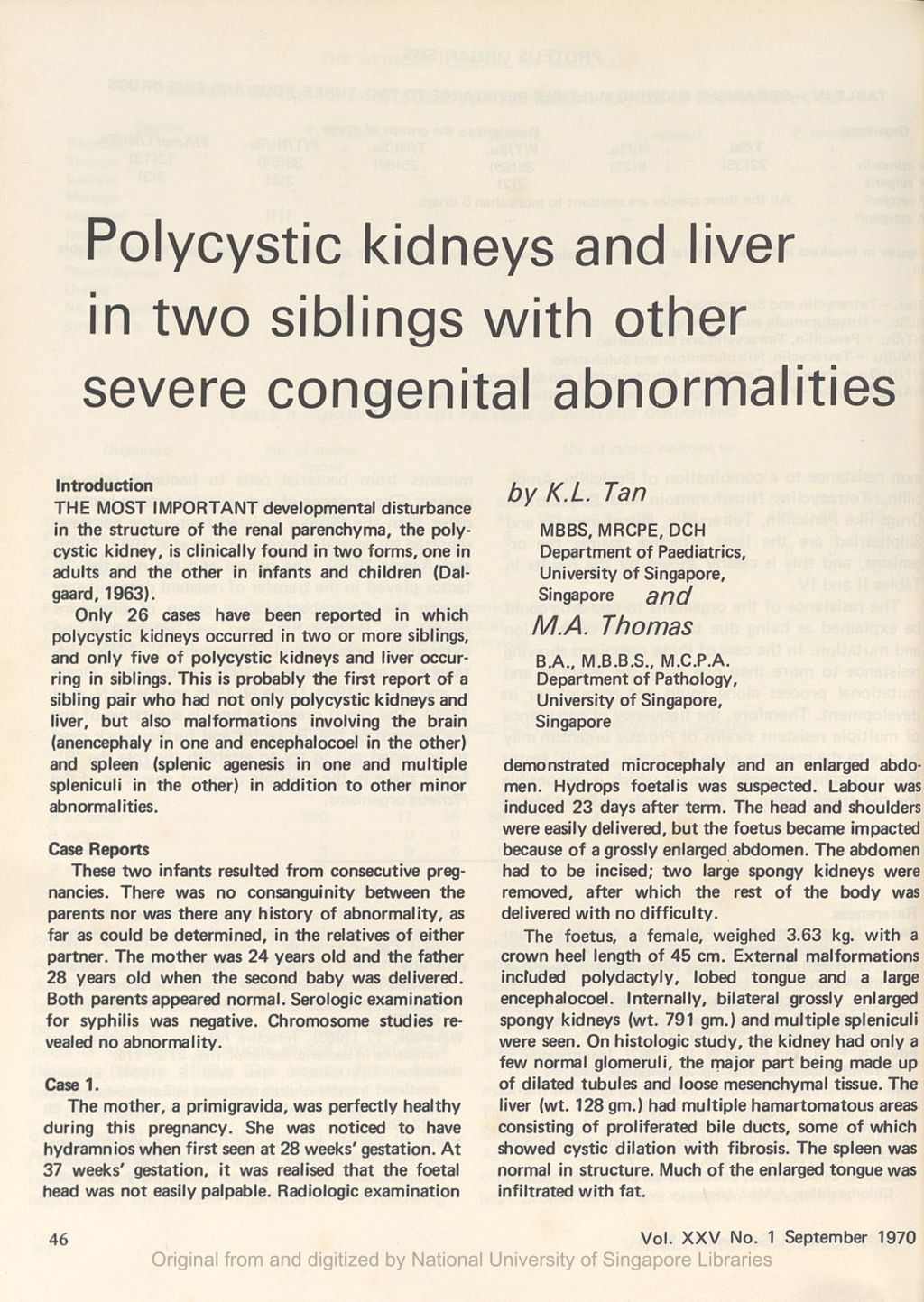 Miniature of Polycystic kidneys and liver in two siblings with other severe congenital abnormalities