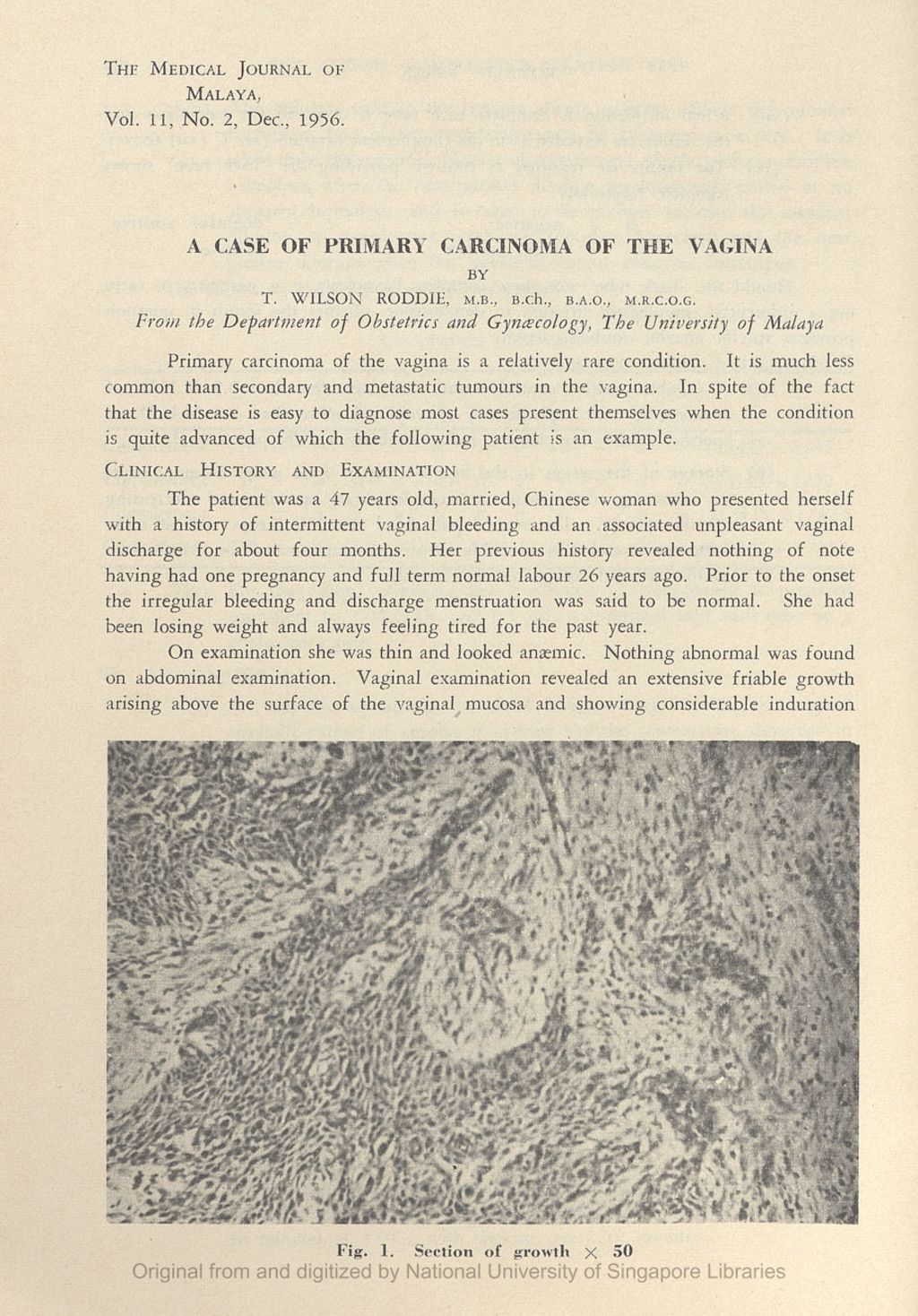 Miniature of Case Of Primary Carcinoma Of The Vagina